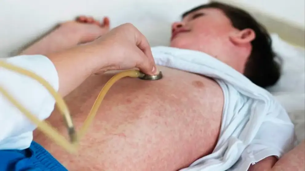 El Ministerio de Salud confirmó un caso de sarampión en un niño de dos años en Santa Elena, Entre Ríos, y emitió una alerta epidemiológica nacional (crédito Mayo Clinic)