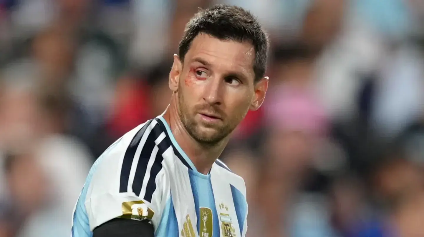 Messi sufrió un corte debajo del ojo durante el partido entre Argentina y Suiza