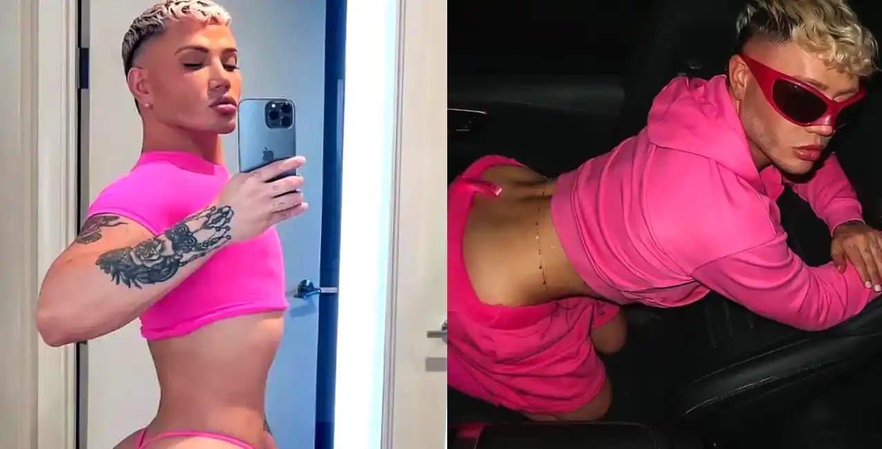 Quién es “Ken Kardashian”: el influencer que gastó 100 mil dólares para operarse como una barbie