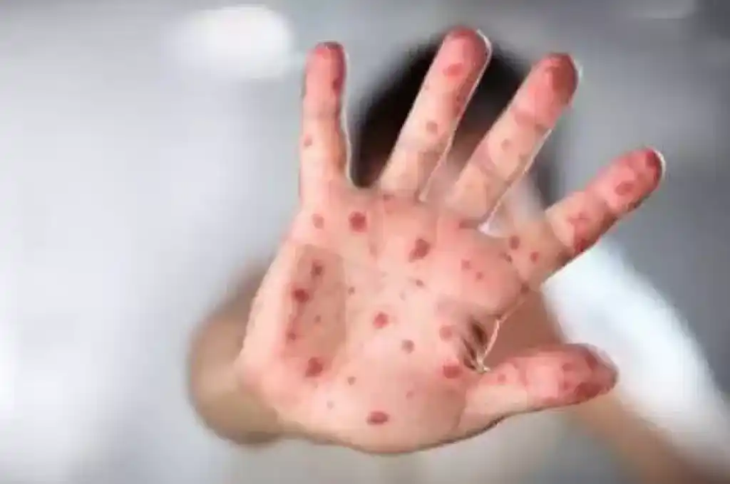 La decisión fue tomada de manera unánime por un Comité de Emergencia.