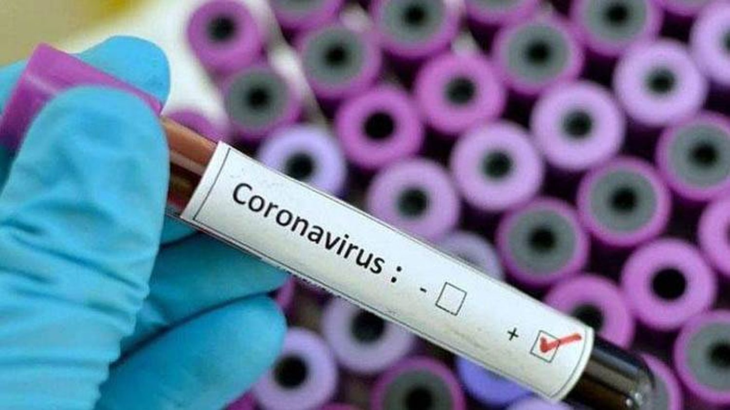 Los casos de coronavirus en las Américas