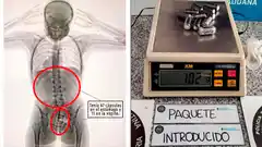 Una joven intentó viajar a España con 78 cápsulas de cocaína en su cuerpo