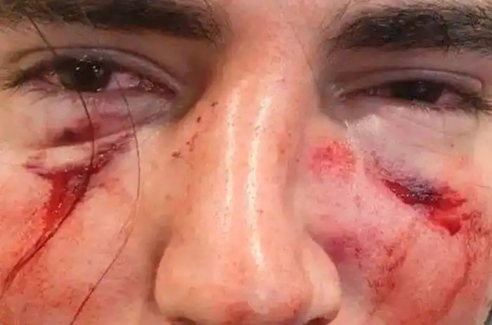 Un grupo de rugbiers atacan con una brutal golpiza a un chico de 18 años