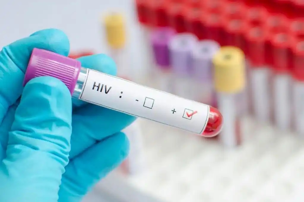 Confirman la cura de un segundo paciente con VIH