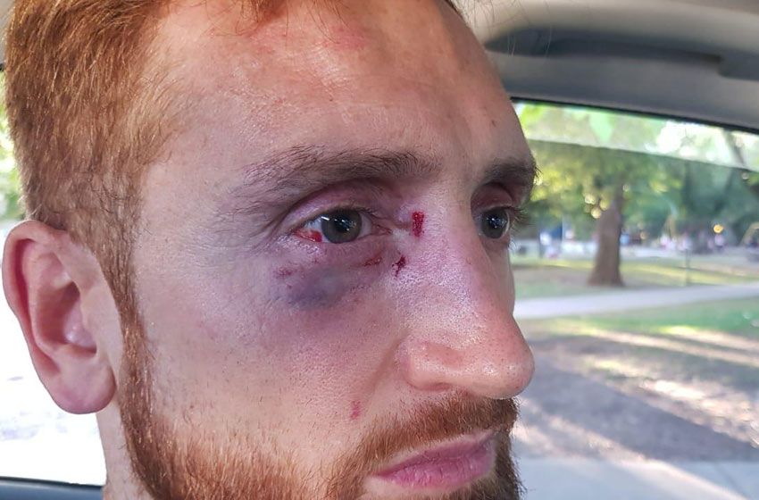 Jugador de Quilmes fue agredido por hinchas de Peñarol