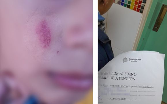 Violencia en la escuela: "Esto sucede en todos lados, hay que actuar"