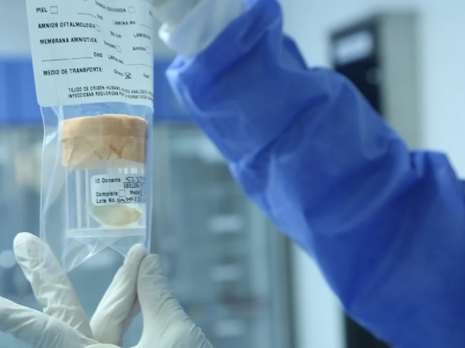 San Francisco y la región cuentan con el primer centro de implantes de tejido óseo