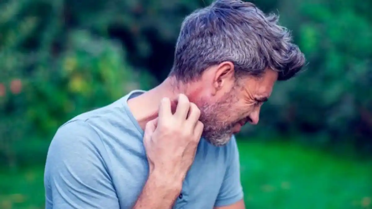 Descubren por qué los mosquitos pican más a unas personas que a otras