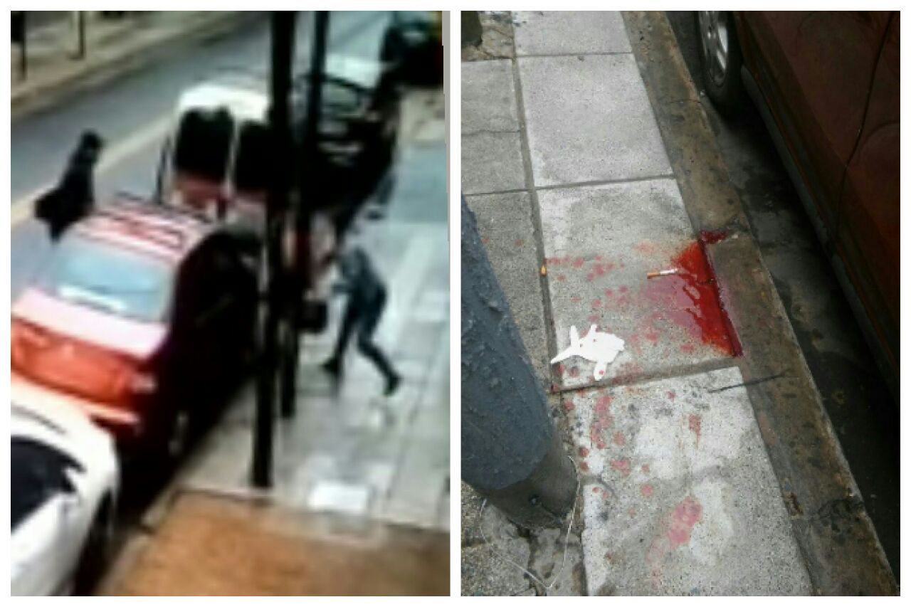 Quiso denunciar que la marcaron y no le creyeron: La desfiguraron para robarle en Munro