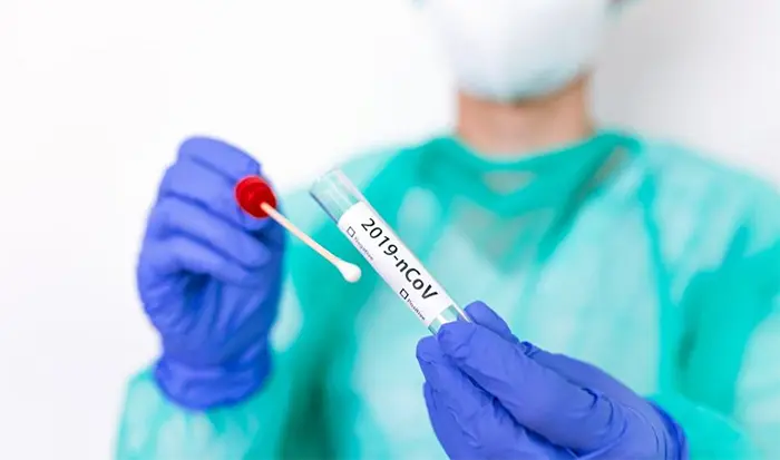 Coronavirus: el día con menos casos desde marzo, aunque con menor cantidad de testeos