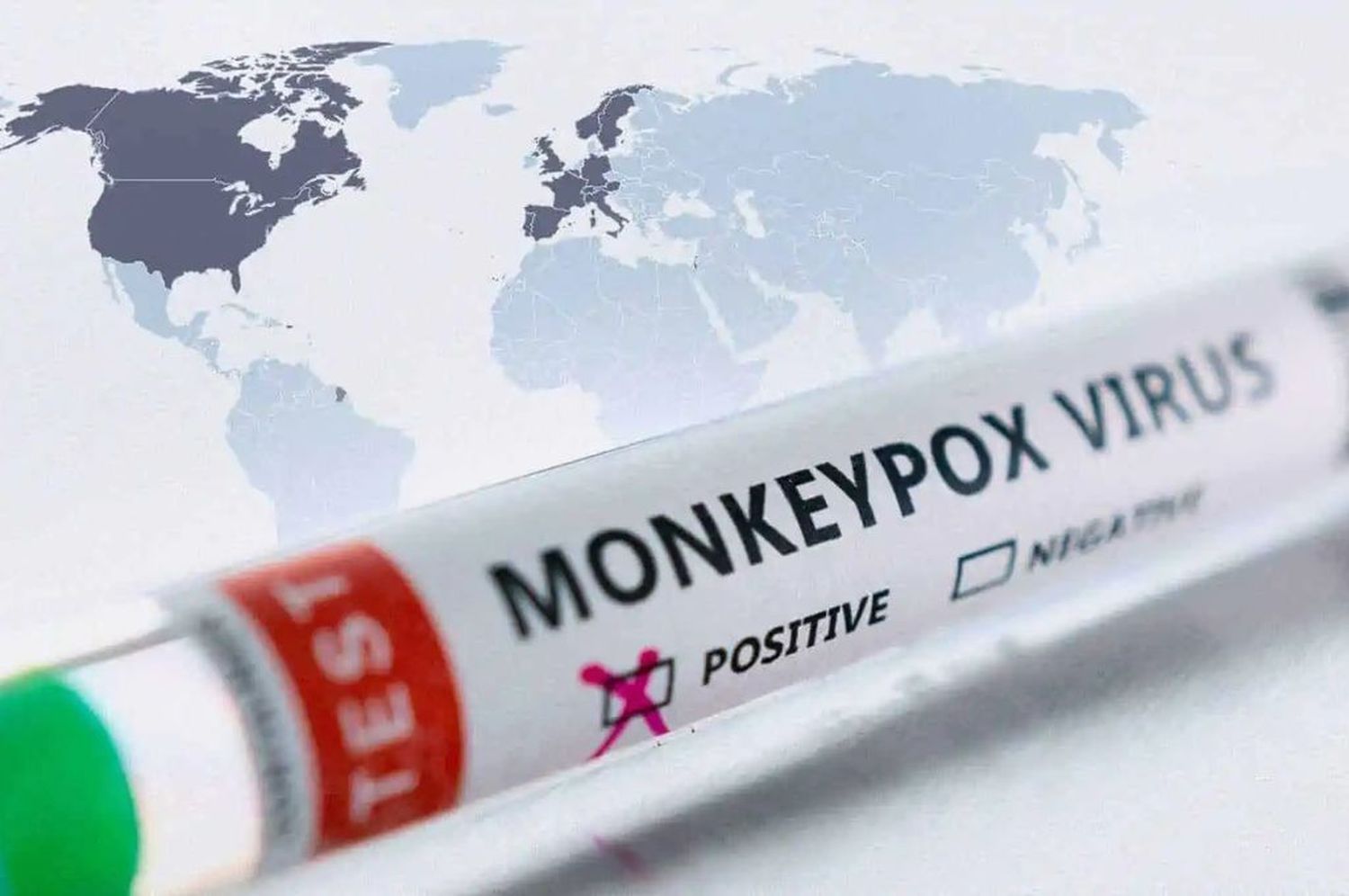 La OMS confirma 1.285 casos de viruela del mono en 28 países no endémicos