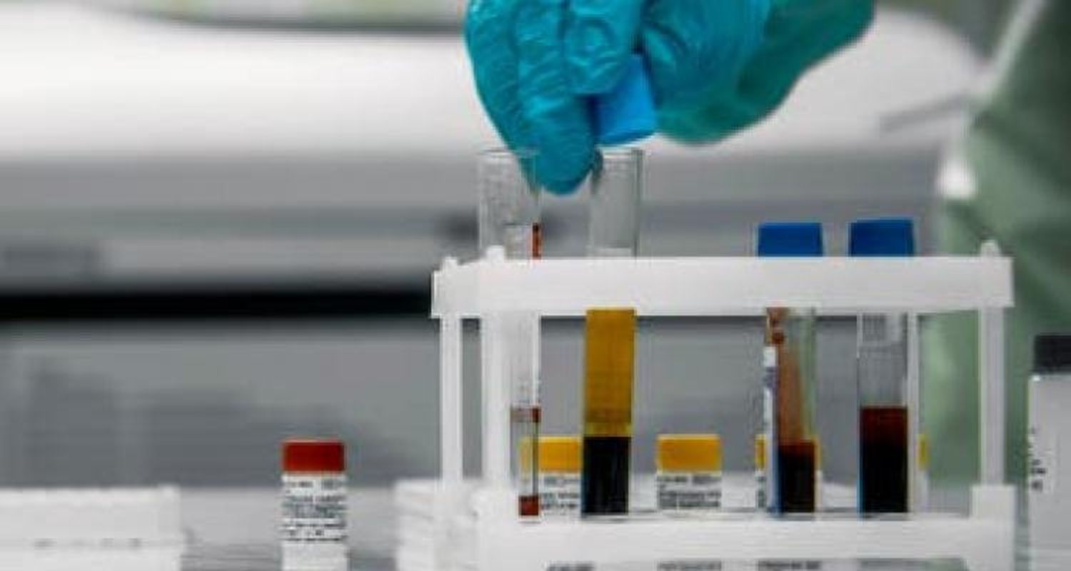 Coronavirus: Llegaron 17 nuevos resultados positivos