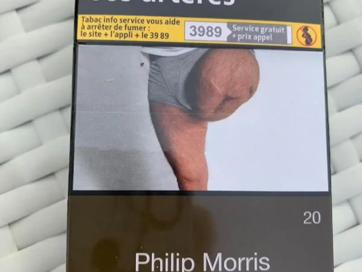 Encontró la foto de su pierna  en un paquete de cigarrillos