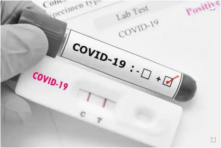 ¿Cómo deben hacer los docentes para justificar las faltas por COVID-19?