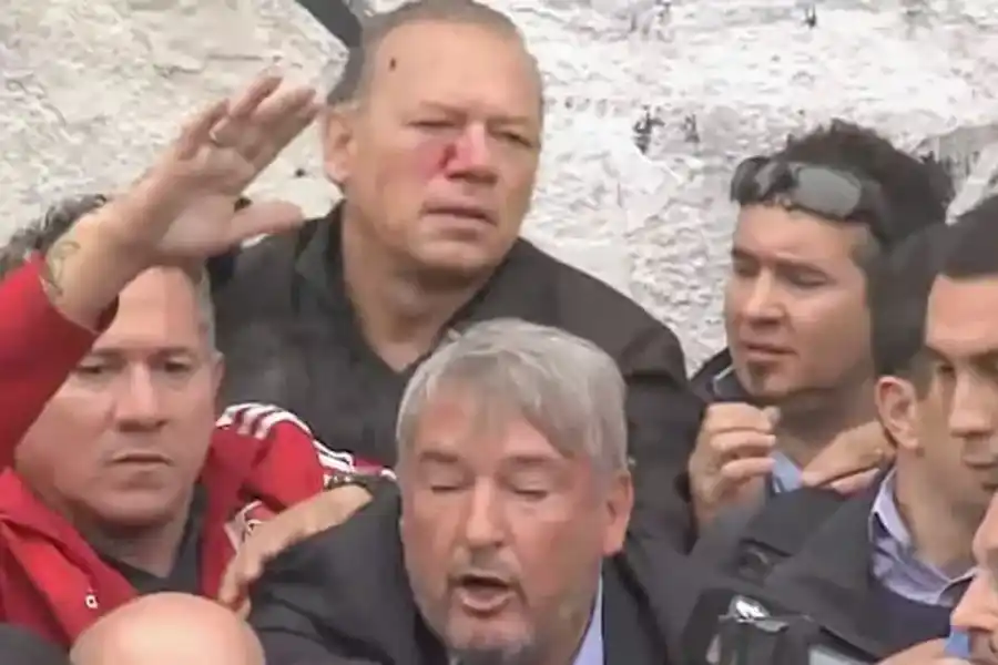 Así quedó Berni luego de las agresiones recibidas