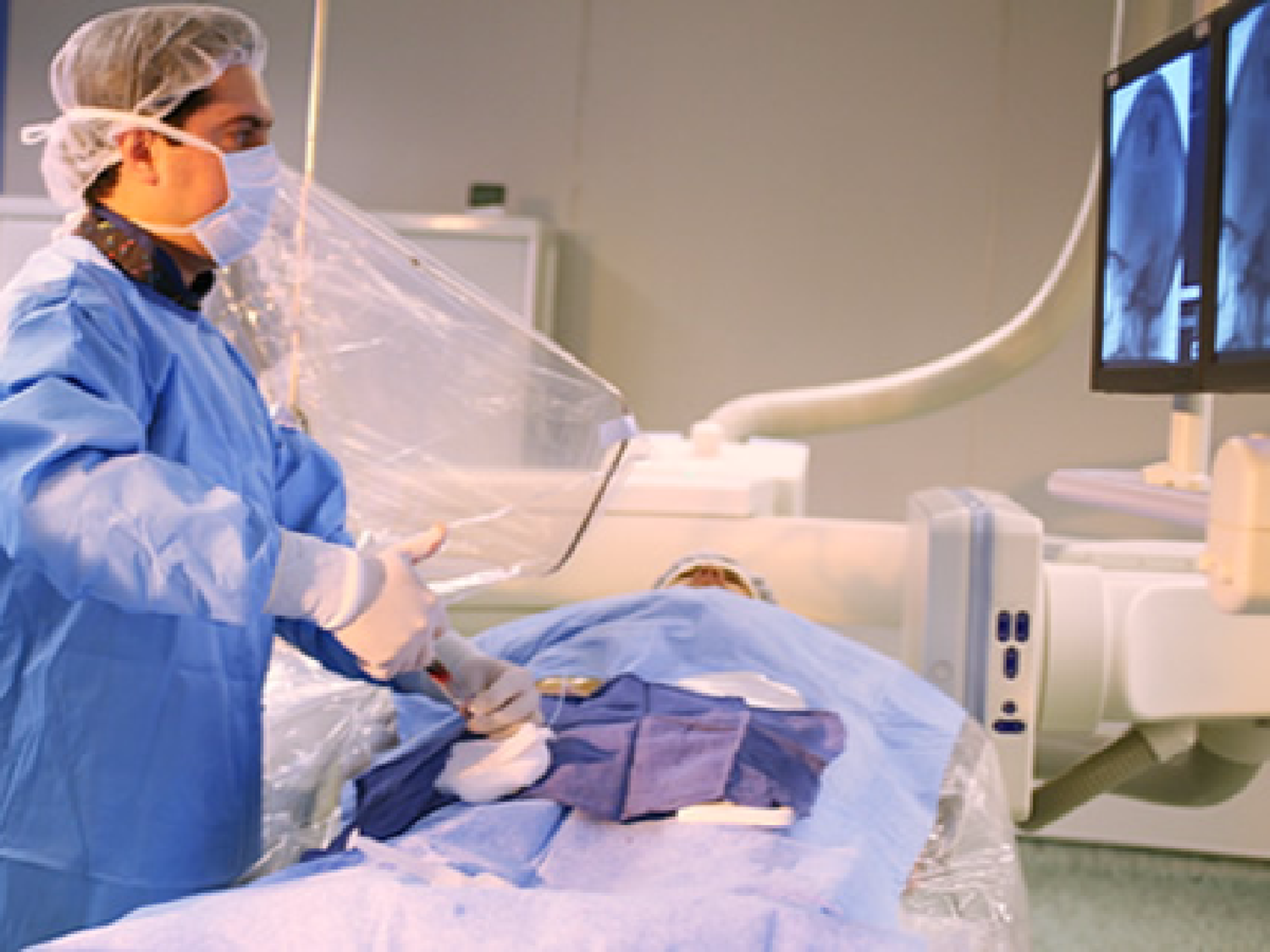 Angiografía cerebral, un estudio clave para el tratamiento de aneurismas