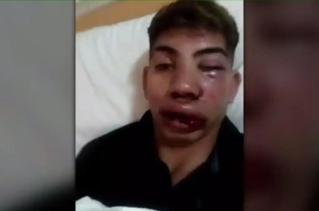 Nazareno, joven agredido