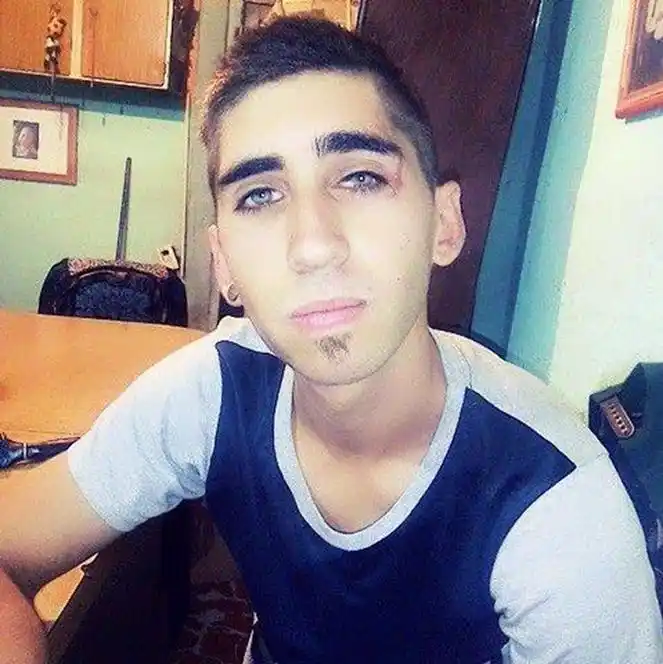 Falleció el joven motociclista que había  chocado contra un auto en Machado y Montiel
