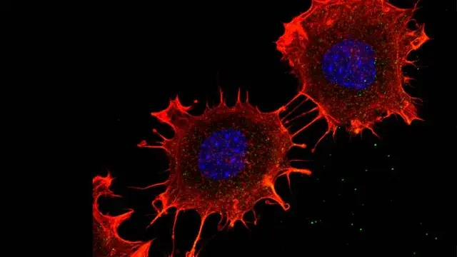 Hallazgo clave para una nueva terapia contra el cáncer de colon