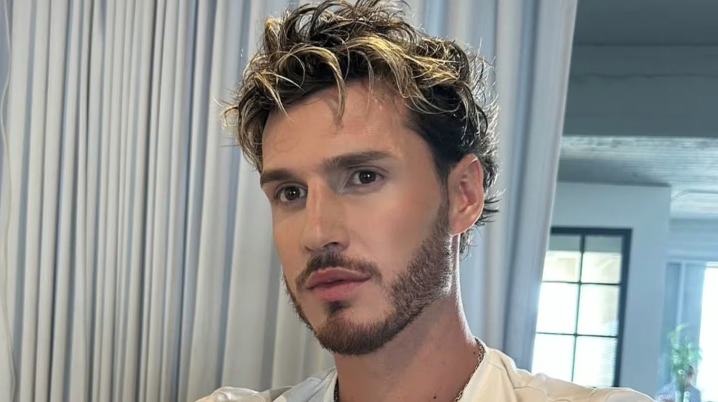 El modelo y cantante iba a debutar el lunes en un programa de televisión.