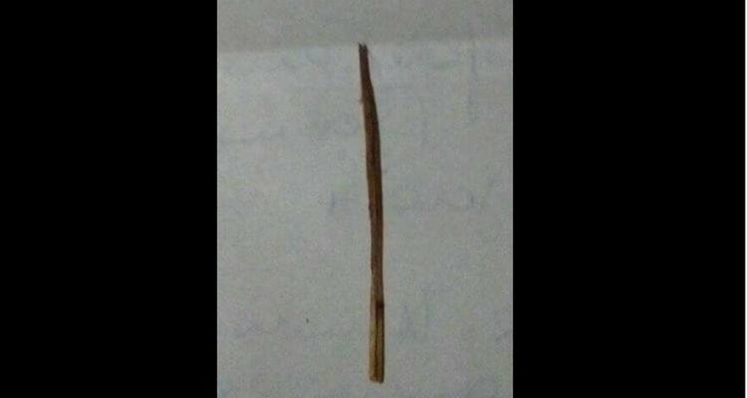 Tiene 5 años, se tiró del tobogán de la Plaza de la Amistad y se clavó una astilla de 5 centímetros en la cola