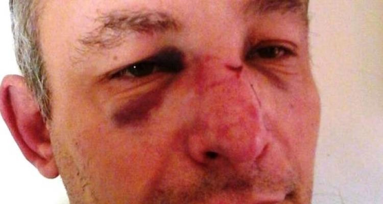 Brutal agresión a empleado de la obra social de la construcción
