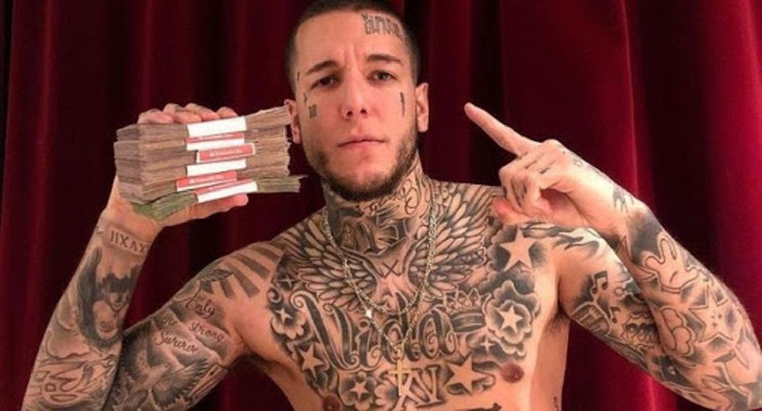 Alex Caniggia se hizo una sorpresiva operación de mandíbula y mostró el resultado en las redes