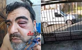 Video muestra brutal ataque en Adrogué: vecino sufre cuatro fracturas en su rostro tras discusión de tránsito