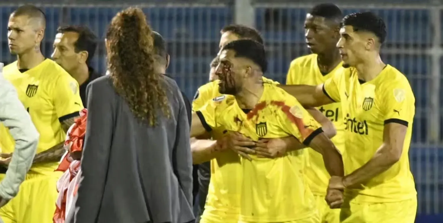El futbolista quedó sangrando y enloqueció contra los hinchas locales.