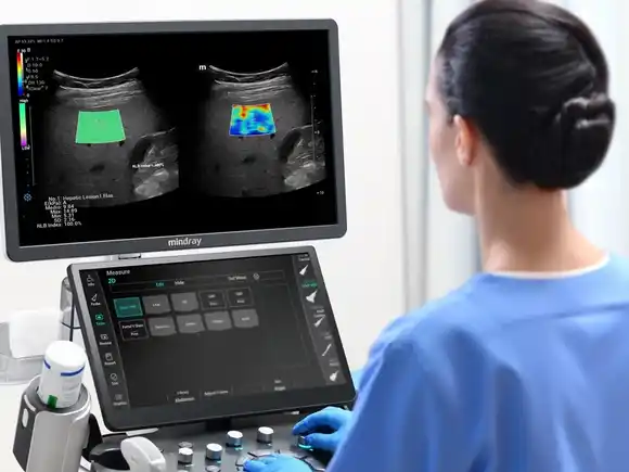 Exitosa prueba piloto de turnos de ecografía en el HIGA