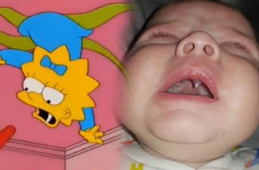 ¿Maggie, sos vos? A un bebé de 11 semanas le creció un extraño colmillo durante la noche