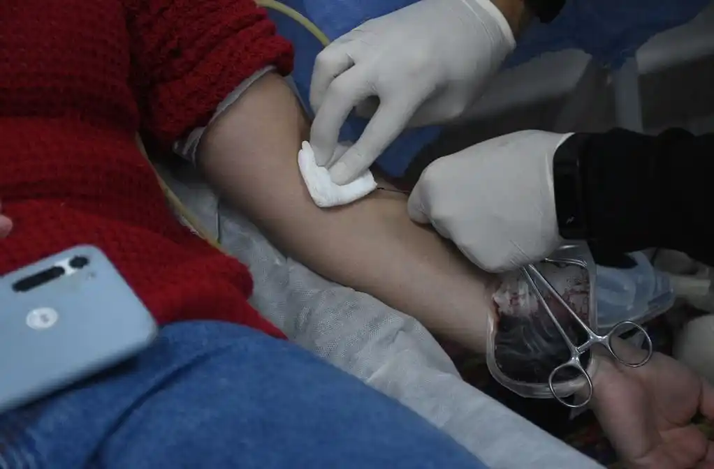 Para ser donante de médula ósea primero se empieza con la extracción de una muestra de sangre y se manda Incucai. Imagen de referencia