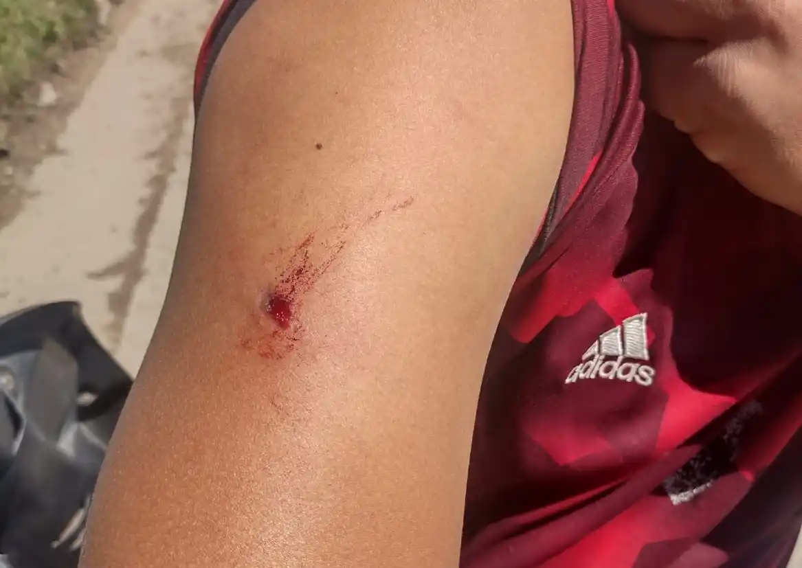 Rufino: un joven fue herido de bala frente a su pareja e hija, a plena luz del día