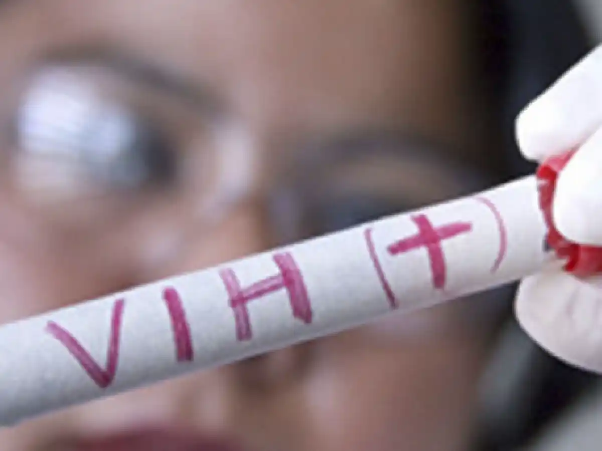 Prueban en humanos una vacuna contra el VIH