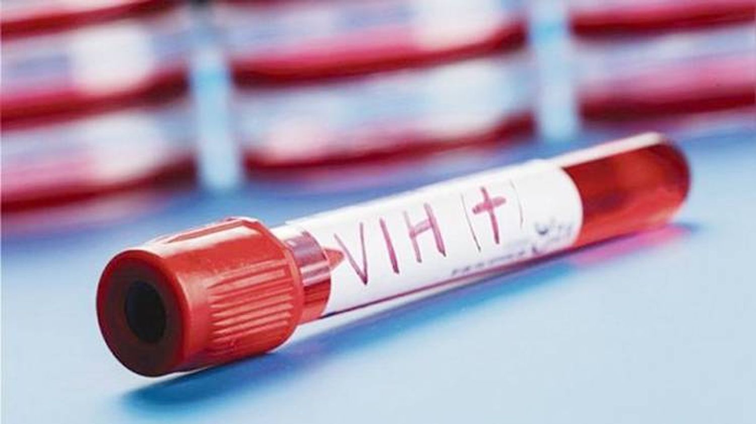 Alerta por la suba de infecciones de transmisión sexual en adolescentes