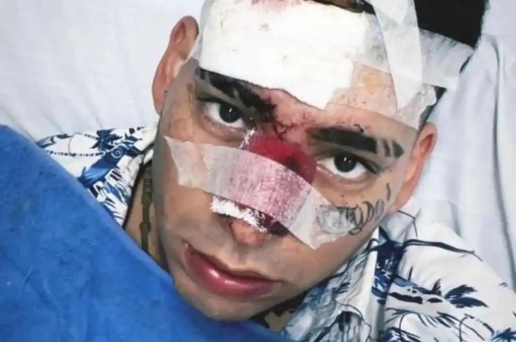 Kaleb di Masi asegura estar vivo de milagro tras chocar con su auto y dejó un educativo mensaje a sus seguidores