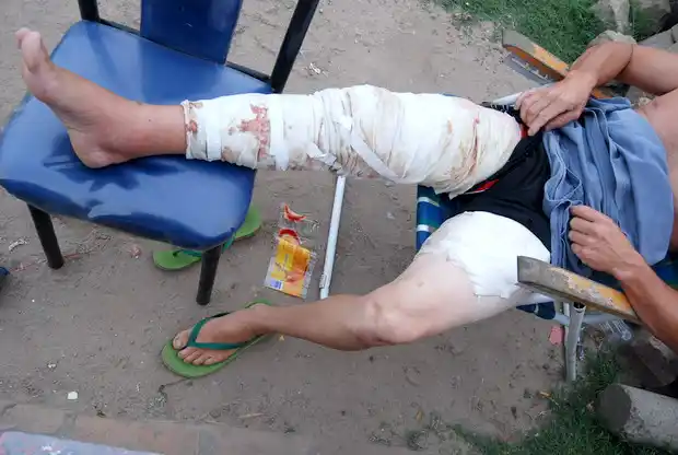 Descansa en su vivienda el hombre que recibió descarga eléctrica