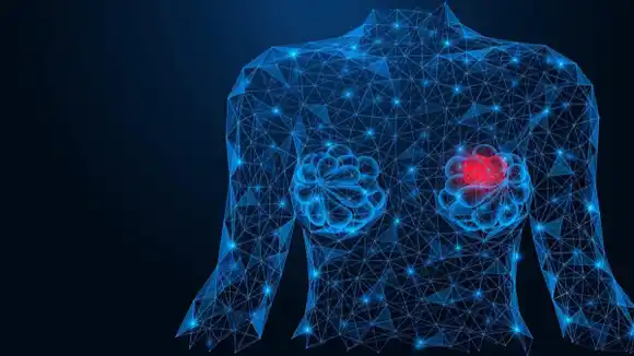 IA revoluciona la detección del cáncer de mama: examinan mamografías con precisión