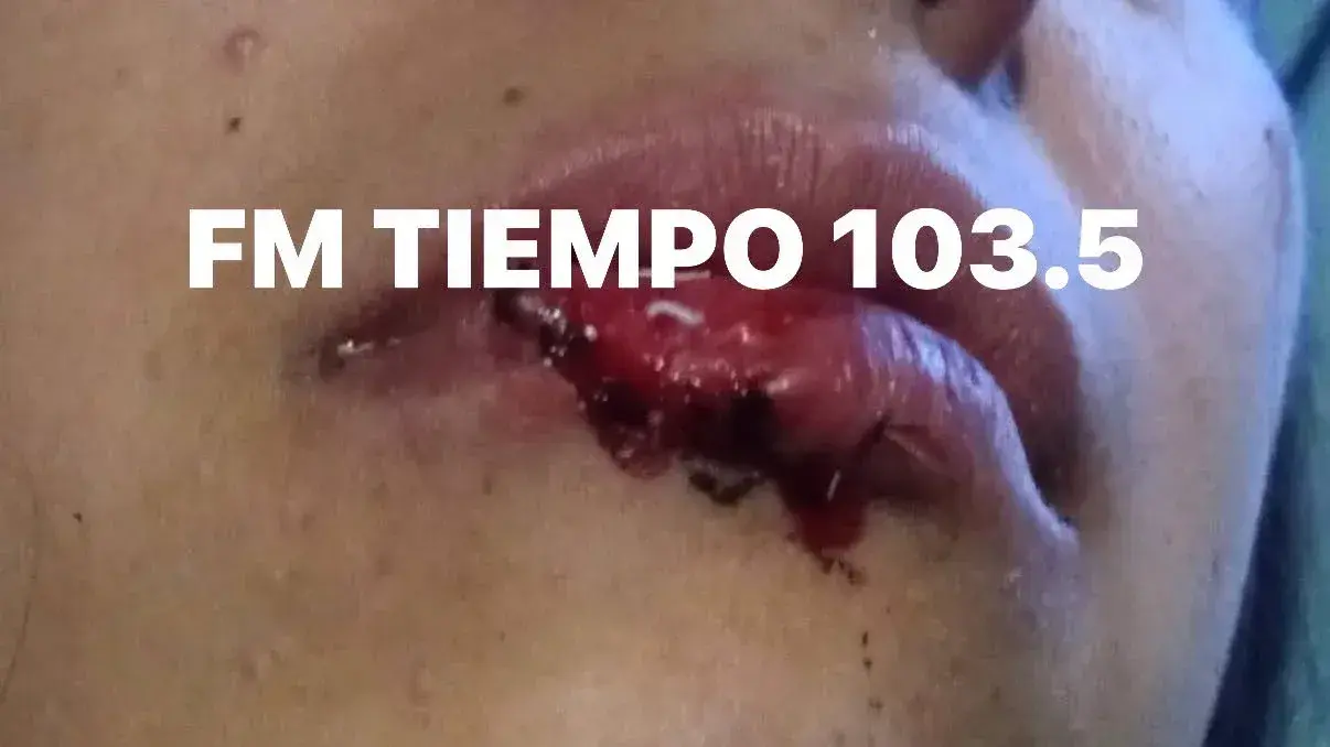 Foto: FM Tiempo Baradero
