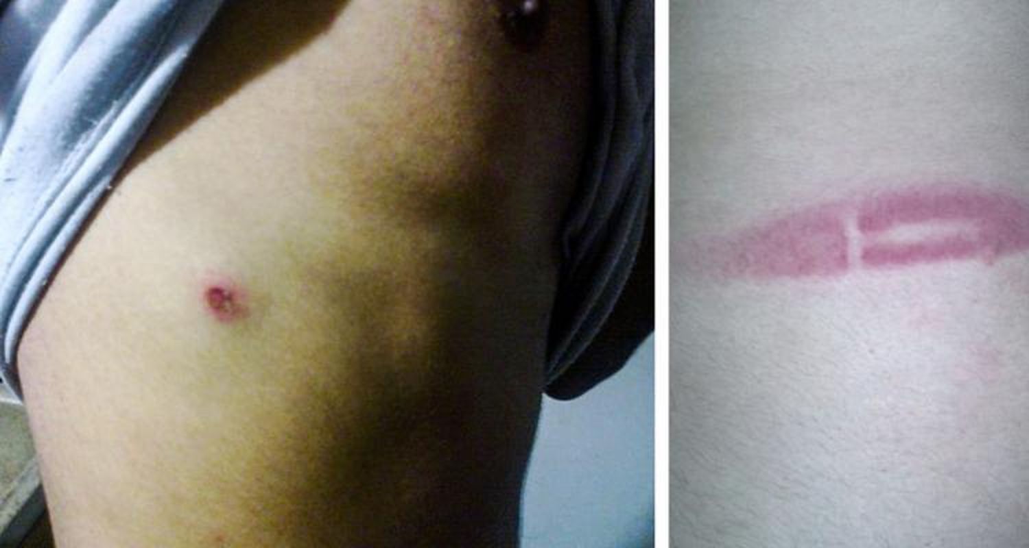 Suman denuncias  por apremios contra la policía