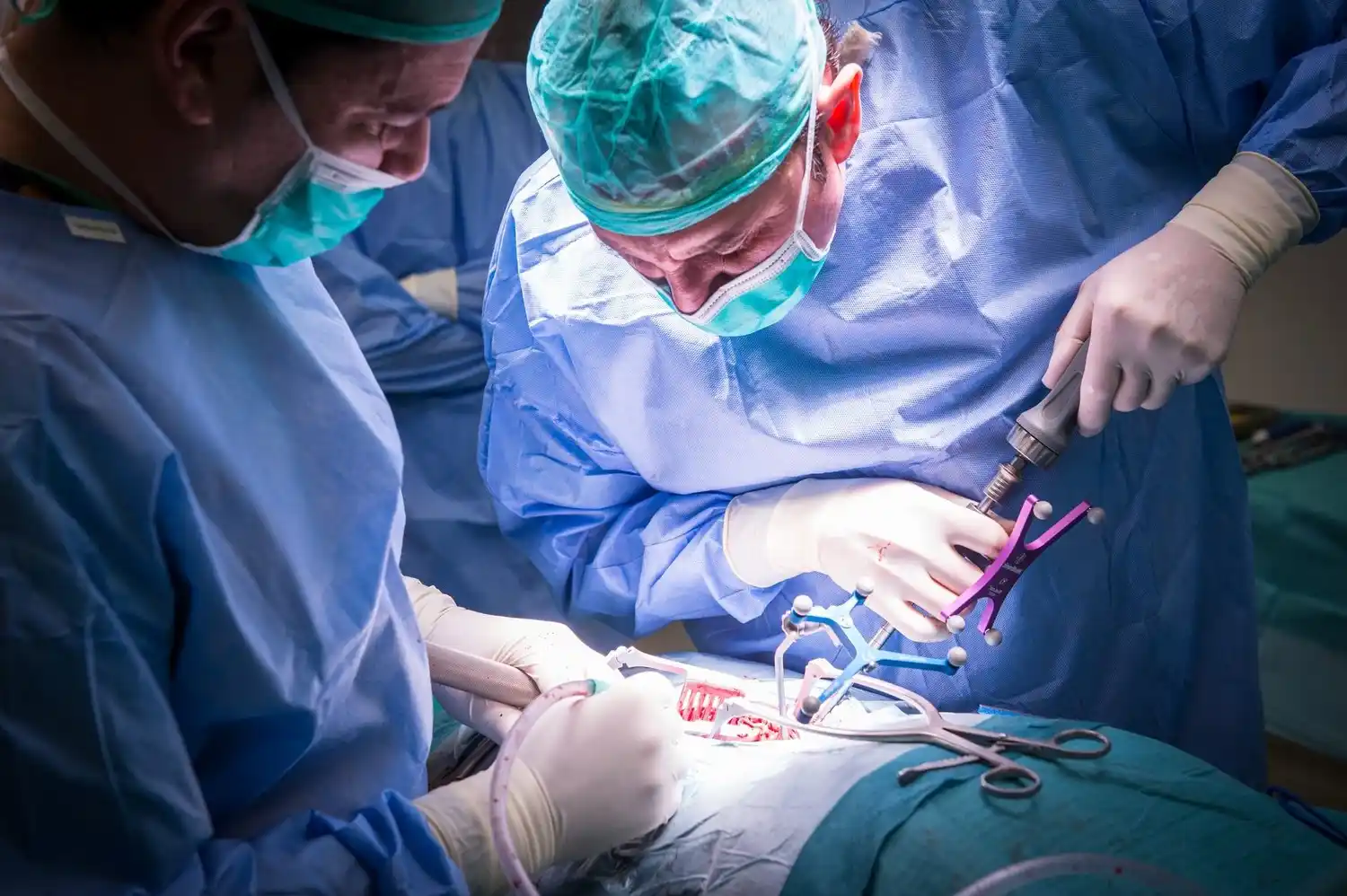 ¡IMPRESIONANTE! Logran extirpar un tumor cerebral con el paciente despierto