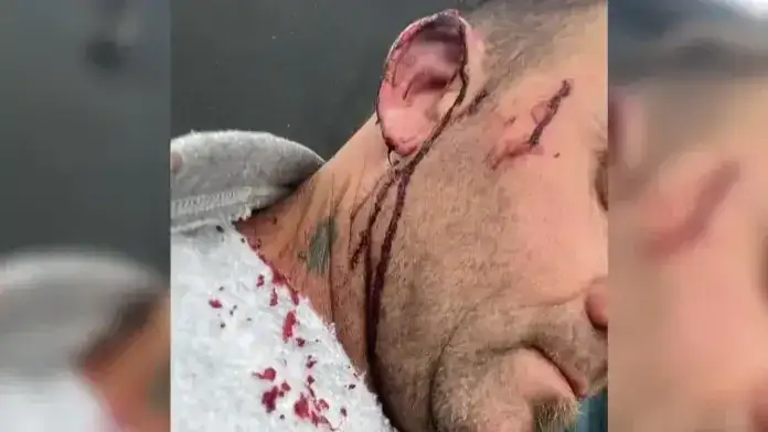 Intendente entrerriano resultó herido tras una pelea con un concejal
