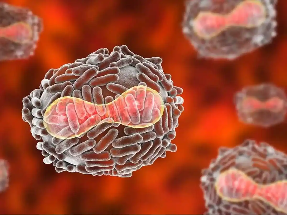 Médica de Rafaela que trabaja en Londres | Preocupación en todo el mundo por la viruela del mono