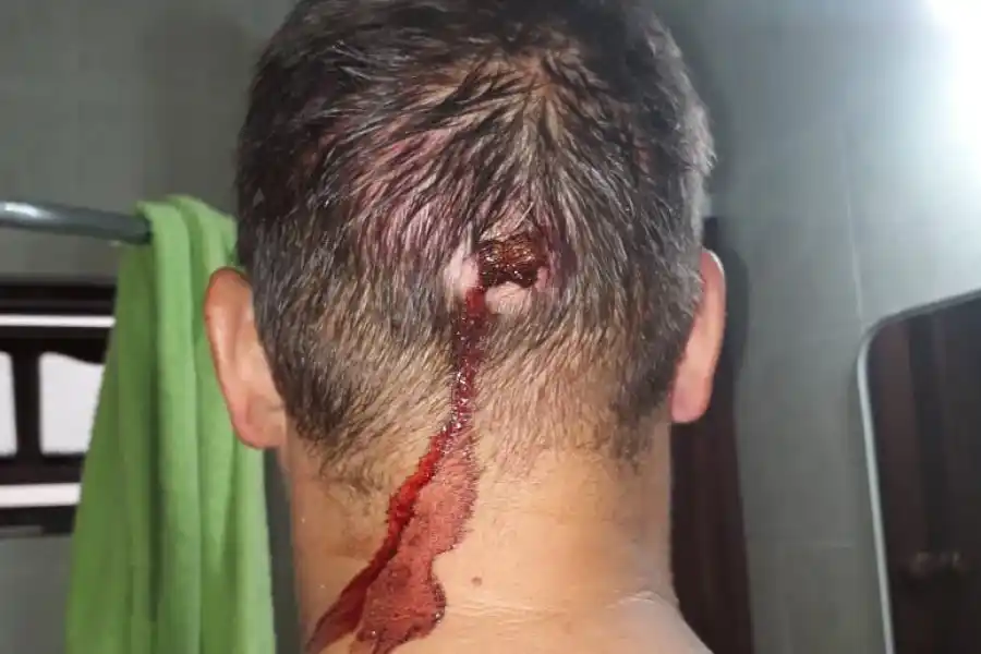 Causa Cura Monzón: atacaron a un periodista