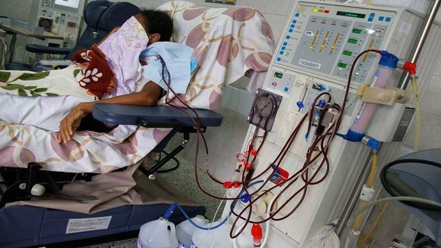 «No sabemos quién será el próximo»: mueren 7 pacientes renales en Lara por falta de tratamiento