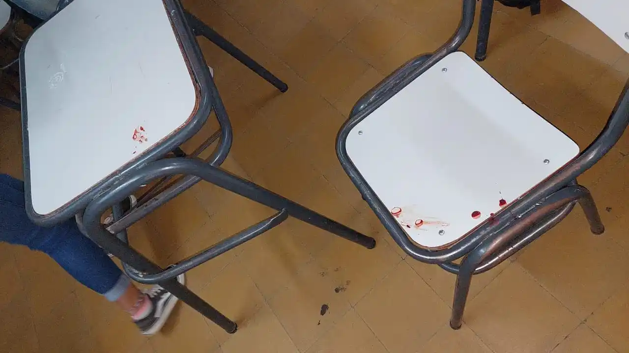 Estaban en clases cuando le cayó un ventilador de techo en la cabeza