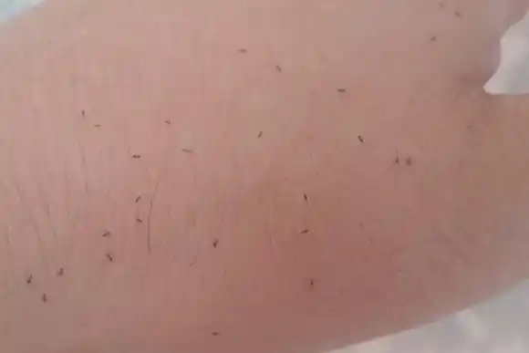 Invasión de "bichitos negros" en Buenos Aires: qué son, cómo combatirlos y qué daños pueden provocar en al piel