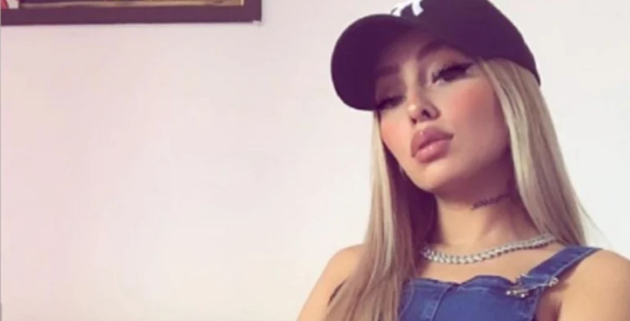 Tamara Báez, la novia de L-Gante, se hizo un retoque estético en la cara
