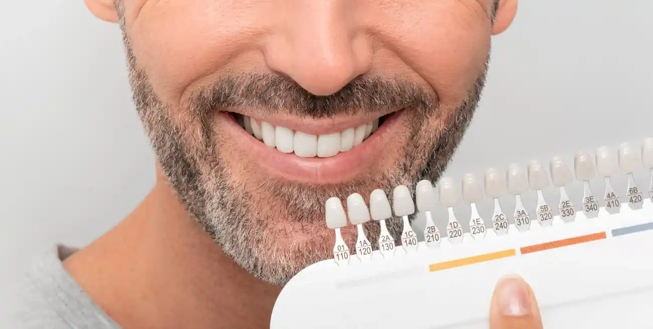 Diversos alimentos y bebidas pueden alterar el color de los dientes y dañar el esmalte.