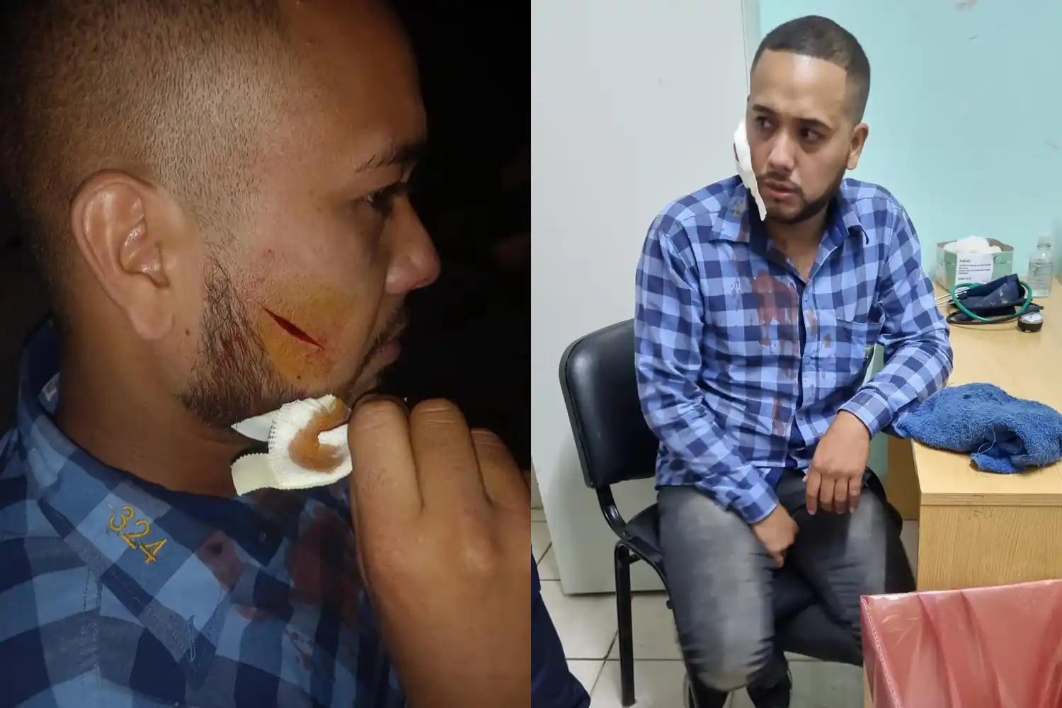 Florencio Varela: Le desfiguraron la cara a un colectivero de la línea 324 para robarle el celular y la billetera